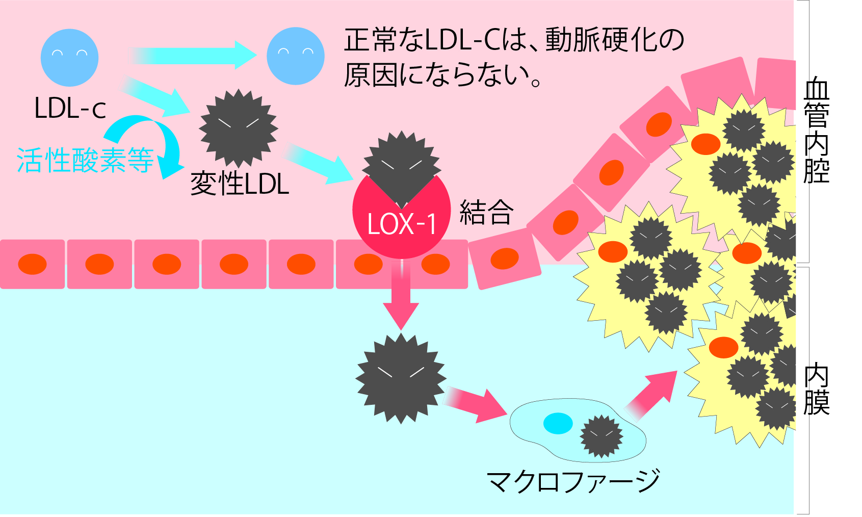 原因 脳 梗塞